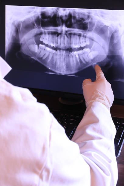 Best Teeth Whitening  in Troy, NC