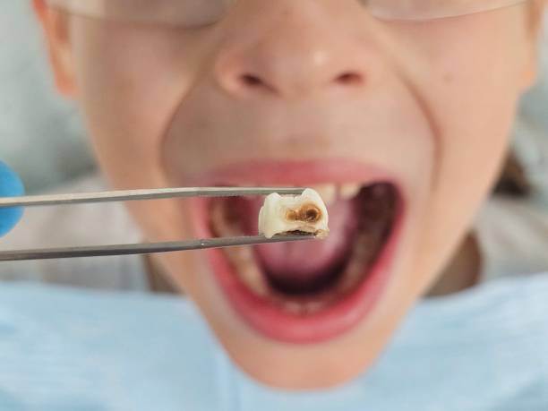 Best Broken Tooth Emergency  in Troy, NC